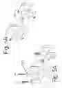 Fig. 07 - INTER-VERTEBRAL ORTHOPEDIC DEVICE PLACEMENT