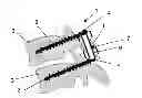 Fig. 01 - Dynamic stabilizing device for bones