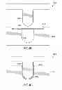 Fig. 06 - BONE FIXATION SYSTEM