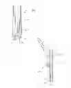 Fig. 41 - Bone plate system
