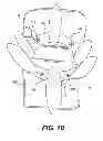 Fig. 08 - Facet joint prosthesis