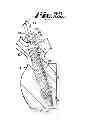 Fig. 07 - POLYAXIAL BONE ANCHOR WITH NON-PIVOTABLE RETAINER AND POP-ON SHANK, SOME WITH FRICTION FIT