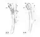 Fig. 03 - Bone fixation rod and implantation device for insertion thereof