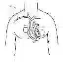 Fig. 01 - Intelligent self-organizing electrode stimulation delivery system