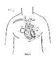 Fig. 05 - Intelligent self-organizing electrode stimulation delivery system
