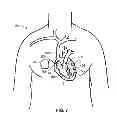 Fig. 06 - Intelligent self-organizing electrode stimulation delivery system