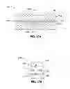 Fig. 10 - Intelligent self-organizing electrode stimulation delivery system