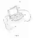 Fig. 04 - Method and apparatus for phrenic stimulation detection