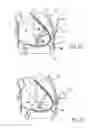 Fig. 12 - IMPLANTED CARDIAC DEVICE FOR DEFIBRILLATION