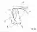 Fig. 18 - IMPLANTED CARDIAC DEVICE FOR DEFIBRILLATION