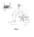 Fig. 02 - Functional electrical stimulation (FES) method and system to improve walking and other locomotion functions