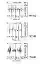 Fig. 07 - Functional electrical stimulation (FES) method and system to improve walking and other locomotion functions