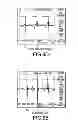 Fig. 08 - Functional electrical stimulation (FES) method and system to improve walking and other locomotion functions