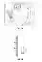 Fig. 02 - Implantable CLIPT illumination system