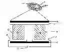 Fig. 01 - FERTILITY PRESERVATION DEVICE