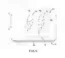 Fig. 06 - Fixation and strain relief element for temporary therapy delivery device