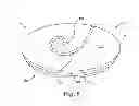 Fig. 08 - Fixation and strain relief element for temporary therapy delivery device