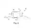 Fig. 09 - Fixation and strain relief element for temporary therapy delivery device