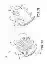 Fig. 08 - Implantable active medical lead