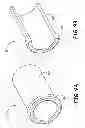 Fig. 10 - Implantable active medical lead