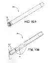 Fig. 11 - Implantable active medical lead