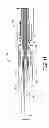 Fig. 12 - Implantable active medical lead