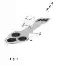 Fig. 02 - Implantable nerve electrode and method for producing an implantable nerve electrode