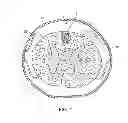 Fig. 02 - Electrode array device configured for placement inside the dura for direct spinal cord stimulation