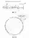 Fig. 12 - Electrode array device configured for placement inside the dura for direct spinal cord stimulation