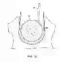 Fig. 15 - Electrode array device configured for placement inside the dura for direct spinal cord stimulation