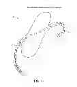 Fig. 16 - Electrode array device configured for placement inside the dura for direct spinal cord stimulation