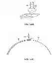 Fig. 31 - Electrode array device configured for placement inside the dura for direct spinal cord stimulation