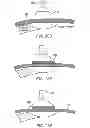 Fig. 32 - Electrode array device configured for placement inside the dura for direct spinal cord stimulation