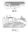 Fig. 33 - Electrode array device configured for placement inside the dura for direct spinal cord stimulation
