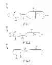 Fig. 02 - Shaped occluding devices and methods of using the same