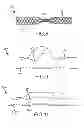 Fig. 05 - Shaped occluding devices and methods of using the same