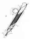 Fig. 06 - Endovascular prosthesis and delivery device