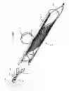 Fig. 09 - Endovascular prosthesis and delivery device