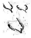 Fig. 13 - Endovascular prosthesis and delivery device
