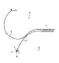 Fig. 26 - Endovascular prosthesis and delivery device