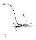 Fig. 31 - Endovascular prosthesis and delivery device