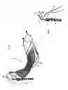 Fig. 32 - Endovascular prosthesis and delivery device