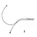 Fig. 38 - Endovascular prosthesis and delivery device