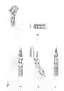 Fig. 40 - Endovascular prosthesis and delivery device