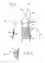 Fig. 02 - Stent Seals and Methods for Sealing an Expandable Stent