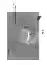 Fig. 02 - Devices, systems and methods for repairing lumenal systems