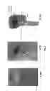 Fig. 04 - Devices, systems and methods for repairing lumenal systems