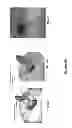 Fig. 05 - Devices, systems and methods for repairing lumenal systems