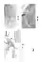 Fig. 10 - Devices, systems and methods for repairing lumenal systems