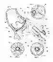 Fig. 03 - Support stent for transvalvular conduit